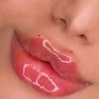 ژل بوتاکس ۳۹۰/ فیلربینی زیرچشم/لیفت صورت شقیقه/نخ|خدمات آرایشگری و زیبایی|تهران, فدک|دیوار