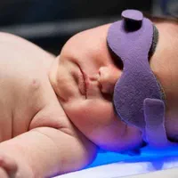 اجاره دستگاه زردی نوزاد کرایه مهتابی تست زردی فوتو|پزشکی|شیراز, اصلاح‌نژاد|دیوار