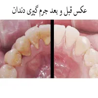 کلینیک دندانپزشکی در کیانپارس میهن شرقی|خدمات آرایشگری و زیبایی|اهواز, کیانپارس |دیوار