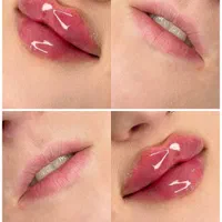 لیفت صورت نخ،ژل لب بوتاکس هایفو لیزر موتیتانیومprp|خدمات آرایشگری و زیبایی|مشهد, وکیل‌آباد|دیوار