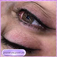 میکروبلیدینگ فیبروز شیدلب بنمژه ریموو|خدمات آرایشگری و زیبایی|شیراز, کوی زهرا|دیوار