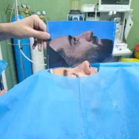 جراحی زیبایی بینی و پلک با بی حسی