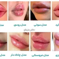 مزو فیلر چربی سوز بوتاکس مصپورت فقط و فقط 750