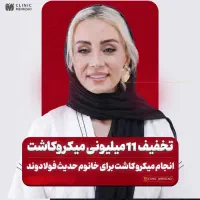 کاشت ابرو تخفیفات نوروزی مهرزاد