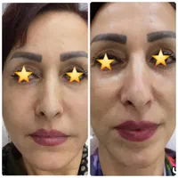 کلینیک زیبایی غزال|خدمات آرایشگری و زیبایی|تهران, خزانه|دیوار