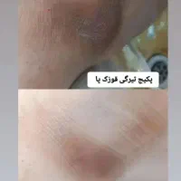 پدیکوروکف سابی پا. پاکسازی دست وپا قوزک ارنج وزانو