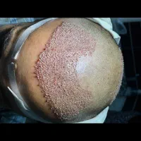 نیازمند کمک‌کاشت و اموزش