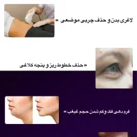هایفوتراپی