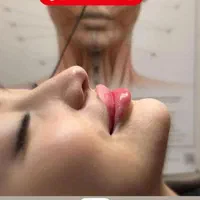 ژل لب زاویه چانه گونه  مزوبوتاکس هایفو لیزرمو زائد|خدمات آرایشگری و زیبایی|مشهد, فرهنگ|دیوار