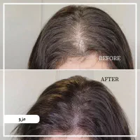 تخفیف ژل بوتاکس مزو آنزیم فیلر غبغب پی ارپی|خدمات آرایشگری و زیبایی|اصفهان, وحید|دیوار