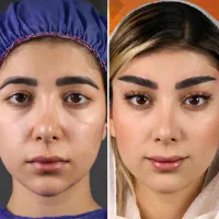 انواع جراحی زیبایی زنان