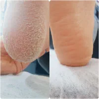 پدیکور و کفسابی پا|خدمات آرایشگری و زیبایی|شاهینشهر, خانه کارگر|دیوار