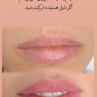 شیدینگ لب خانم و آقا (رفع تیرگی) و درمان خشکی لب|خدمات آرایشگری و زیبایی|اصفهان, فیض|دیوار