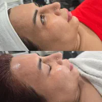 پاکسازی پوست/فشیال تخصصی