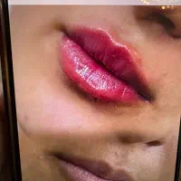 کلینیک زیبایی مهاباد (فیلر بوتاکس لیزرمو مزوتراپی)