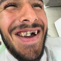 کامپوزیت تا هفته آینده دوفک 24 ت کاریزما آلمان|خدمات آرایشگری و زیبایی|مشهد, هنرستان|دیوار