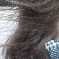 پاکسازی رشک و شپش موی سر در شهرک شهید رجایی|خدمات آرایشگری و زیبایی|مشهد, انصار|دیوار