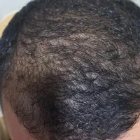 جوانساز پوست|خدمات آرایشگری و زیبایی|کرج, شهرک ظفر|دیوار