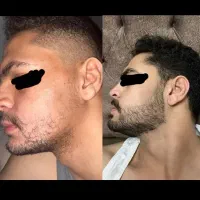 ۱۶ روزه|آرایشی، بهداشتی، درمانی|کرمانشاه, |دیوار