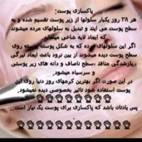 حلزون مولد|خزنده|دزفول, |دیوار