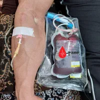 خدمات پرستاری(سرم تراپی،فصدخون،سونداژ درمنزل)|خدمات آرایشگری و زیبایی|تهران, فلسطین (میدان انقلاب)|دیوار