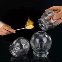 بادکش و حجامت
