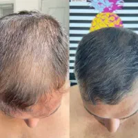 خودتو خلاص کن از ریزش