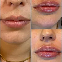 کلینیک پوست ، مو و لیزر|خدمات آرایشگری و زیبایی|شهریار, شهریار|دیوار