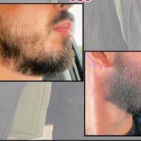 چهرت کامل میشه