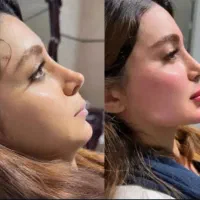 تخفیفات ویژه بوتاکس صورت و فیلر لب،فول فیس و...|خدمات آرایشگری و زیبایی|مشهد, شهید فرامرز عباسی|دیوار