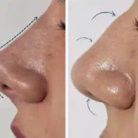 تخفیف روز مادر|خدمات آرایشگری و زیبایی|رشت, بوسار|دیوار