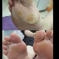 جشنواره تخفیف خدمات ناخن تنها تا پایان شهریور|خدمات آرایشگری و زیبایی|تهران, چهارصد دستگاه|دیوار