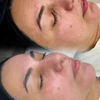 تخفیفات ۵۰ درصدی ژل ،آنزیم بینی ، بوتاکس ، پاکسازی|خدمات آرایشگری و زیبایی|کرمانشاه, |دیوار