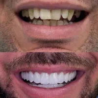 دندانپزشکی اقساطی 2سال شهرکردیها