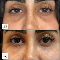 کلینیک پوست ، مو و لیزر|خدمات آرایشگری و زیبایی|شهریار, شهریار|دیوار