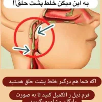 ایا از خلط پشت حلق رنج میبری