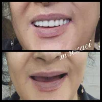 دندانسازی رضایی