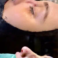 عمل بینی با شرایط ویژه(ماهانه ۱۰تومن)|خدمات آرایشگری و زیبایی|مهاباد (آذربایجان غربی), |دیوار