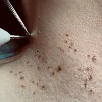 خال|خدمات آرایشگری و زیبایی|سرپل ذهاب, |دیوار