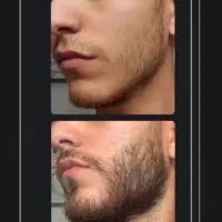 با سرم اینجوری شده ها