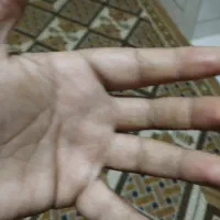 ۴ عدد کبوتر طوقی پلاکی کلی