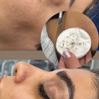 پاکسازی و فیشال صورت|خدمات آرایشگری و زیبایی|سمنان, |دیوار