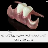 پروتز دندان دندانسازی تضمینی|آرایشی، بهداشتی، درمانی|صفادشت, |دیوار