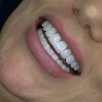 نیازمند دندانپزشک