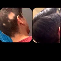 محلول تخصصی ریش وآلوپسی