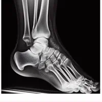 خدمات شکسته‌بندی