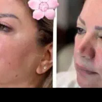 اندولیفت.لیپوفیس.ساکشن غبغب با اولترا زد|خدمات آرایشگری و زیبایی|مشهد, سناباد|دیوار