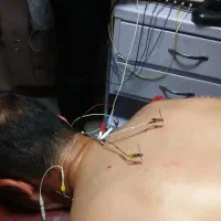 انجام فیزیوتراپی و طب سوزنی در کلینیک هفده شهریور