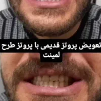 کلینک* تاج*  لبخندی  زیبا  ب شما  هدیه  میدهد|خدمات آرایشگری و زیبایی|باقرشهر, |دیوار