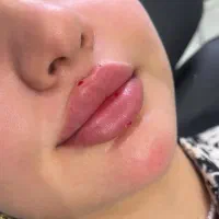 خدمات زیبایی هر سی سی فیلر ۸۵۰|خدمات آرایشگری و زیبایی|اصفهان, تیران|دیوار